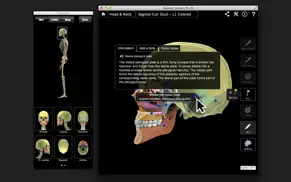skeletal system pro iii iPhone Captures Décran 3