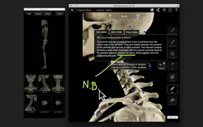 skeletal system pro iii iphone capturas de pantalla 2