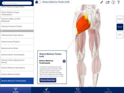 rehabilitation for lower limbs iPad Captures Décran 2