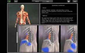 muscle trigger point anatomy iphone capturas de pantalla 3