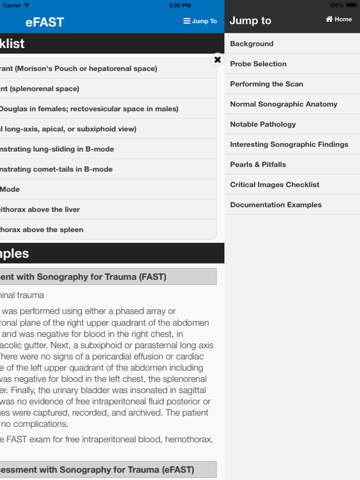 sonosupport: a clinical emergency medicine and critical care ultrasound reference tool ipad images 4
