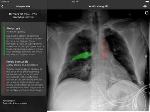 realworld radiology ipad resimleri 4