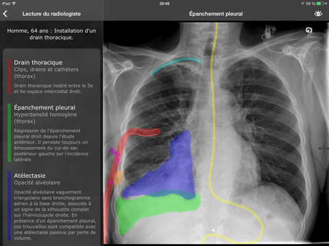 realworld radiology iPad Captures Décran 1