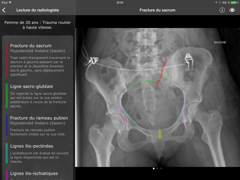 realworld orthopaedics iPad Captures Décran 3