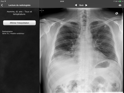 realworld radiology iPad Captures Décran 3