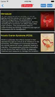 gynaecology - understanding disease iphone images 2