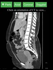 radiology ct viewer ipad images 3