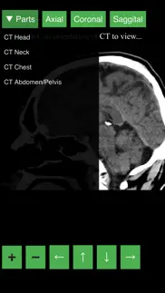 radiology ct viewer iphone images 4