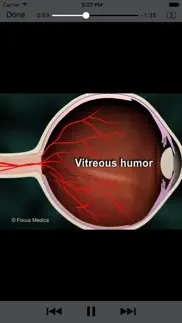 ophthalmology - understanding disease iphone images 4