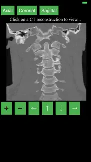 ct cervical spine iphone images 3