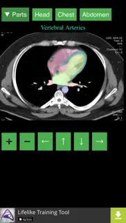 anatomy on radiology ct iphone images 4