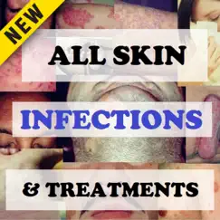 skin infections and treatments commentaires & critiques