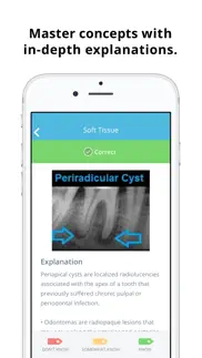 nbde 2 dental boards mastery iphone images 4