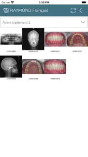 dental photos iPhone Captures Décran 3