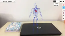 ar vascular system iphone images 3