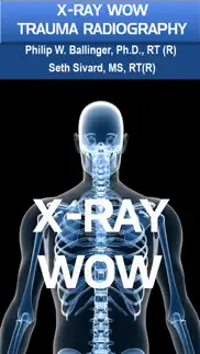 x-ray wow iphone images 1