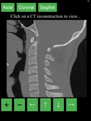 ct cervical spine ipad images 2