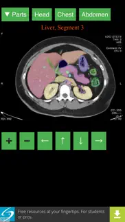 anatomy on radiology ct iphone images 1