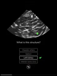 deepscope ultrasound simulator ipad bildschirmfoto 4
