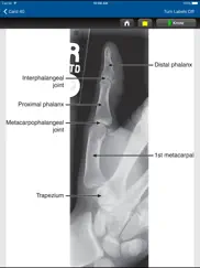 radiographic positioning cards ipad images 4