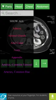 anatomy on radiology ct iphone images 3