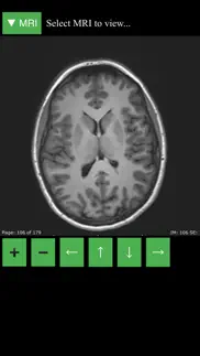 mri viewer iphone images 1