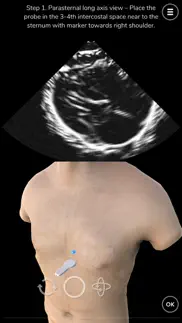 deepscope ultrasound simulator iphone bildschirmfoto 4