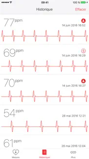 cardiographe iPhone Captures Décran 3