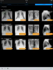 normal x-rays and real cases ipad resimleri 3