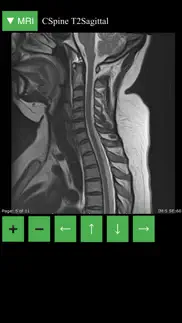 mri viewer iphone images 3