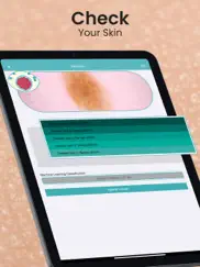 scanner de tu piel ipad capturas de pantalla 1