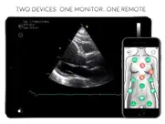 awesome ultrasound simulator ipad bildschirmfoto 1