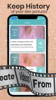 scanner de tu piel iphone capturas de pantalla 4