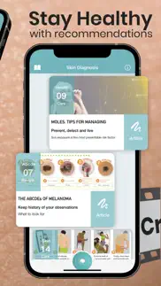 scanner de tu piel iphone capturas de pantalla 3