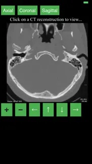ct cervical spine iphone images 1