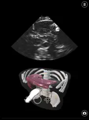 deepscope ultrasound simulator ipad bildschirmfoto 1