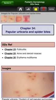 pediatric dermatology ddx deck iphone images 3