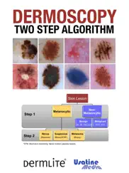 dermoscopy two step algorithm ipad images 1