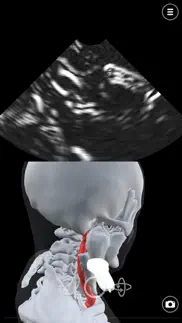 deepscope ultrasound simulator iphone bildschirmfoto 3