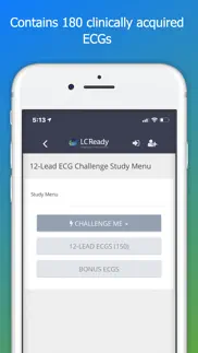 12 lead ecg challenge iphone images 2