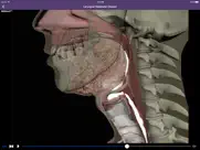 dysphagia iPad Captures Décran 3
