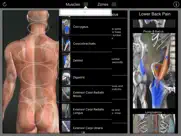 muscle trigger points ipad images 4
