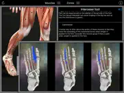 muscle trigger points ipad images 3