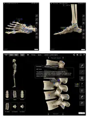 skeleton system pro iii ipad capturas de pantalla 4