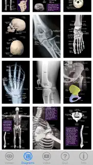 skeletal anatomy 3d iphone resimleri 4