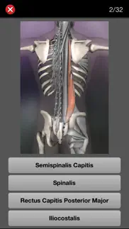 anatomy quiz pro iphone resimleri 3