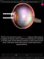 human eye anatomy fact,quiz 2k ipad images 3