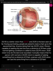 human eye anatomy fact,quiz 2k ipad images 2