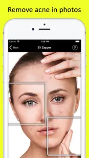 zit zapper - remove pimples iphone images 1