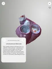 3d heart anatomy ipad capturas de pantalla 1